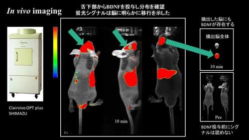 唾液腺、脳に影響を与える臓器であると判明　 唾液中の脳由来神経栄養因子が、抗不安作用を示すと発表