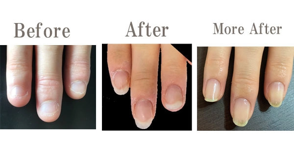 『NAIL CLINIQUE』をリニューアル！ 健康で綺麗に育てる「爪育成」に特化した 爪の専門店として12月から運営開始