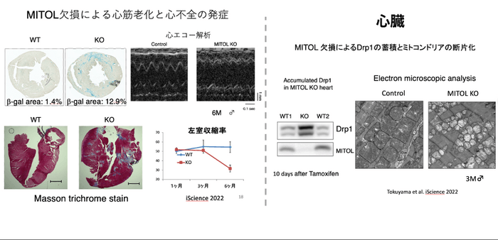 MITOL欠損による心筋老化