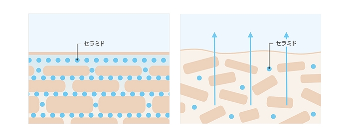 セラミドが豊富な健康肌とセラミド不足の乾燥肌