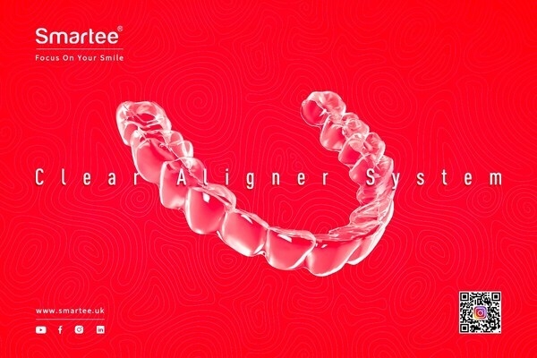 Smartee Aligner