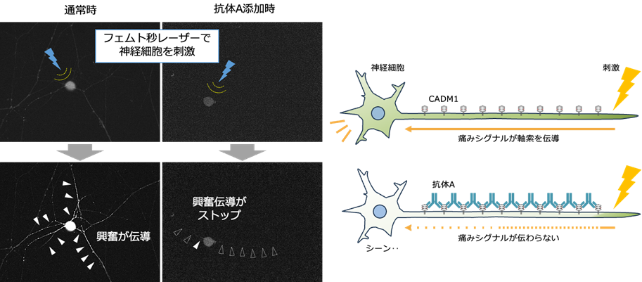 体内で神経に集積して疼痛を抑制する抗体を独自に作製 長時間