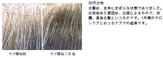 【白髪外来(R)】事例(30代女性)