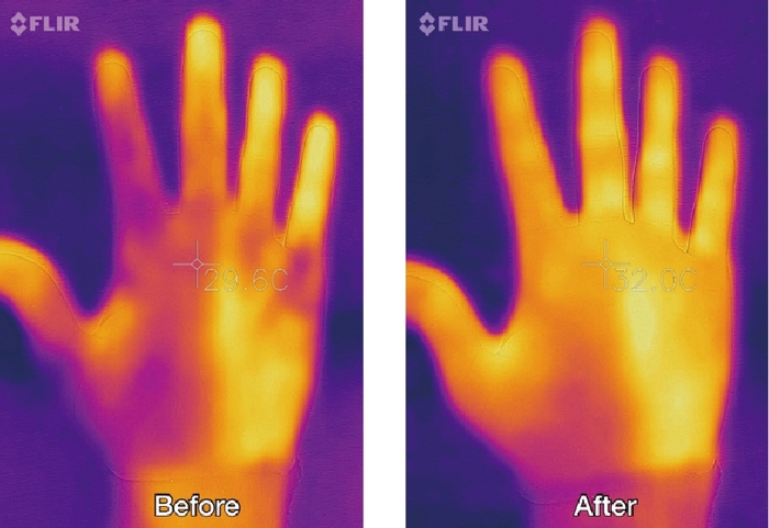 手の温度(サーモグラフィー使用)
