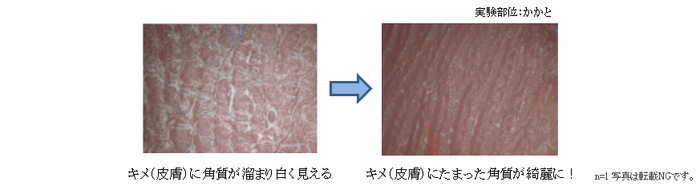 【実験データ2】キメに溜まった角質もケア!