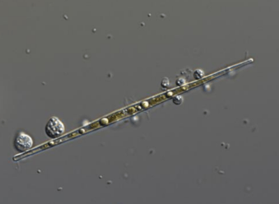 図1.植物プランクトンのイタケイソウの仲間(Ulnaria sp.)に寄生したツボカビ(Rhizophydiales sp.)が成熟し、胞子嚢(のう)になったところ