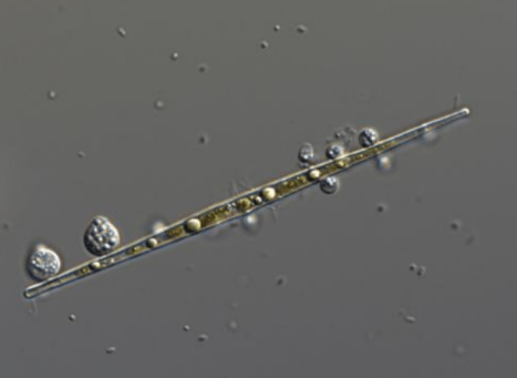 図1．植物プランクトンのイタケイソウの仲間（Ulnaria sp.）に寄生したツボカビ（Rhizophydiales sp.）が成熟し、胞子嚢（のう）になったところ