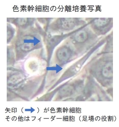 ヒトの皮膚から色素幹細胞の分離培養技術を確立！ ～これまで困難であった色素異常の発症メカニズムの解明に期待～