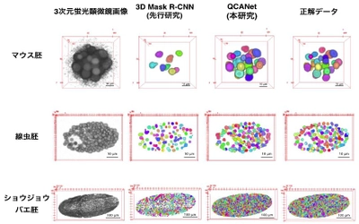 生殖補助医療につながる革新的AI開発に成功　－不妊症の原因となる卵子の質の評価に応用可能－