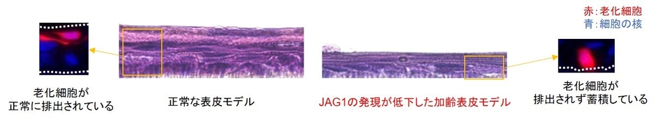 図3. JAG1の発現低下により老化細胞が排出できなくなることで表皮のターンオーバーが停滞する