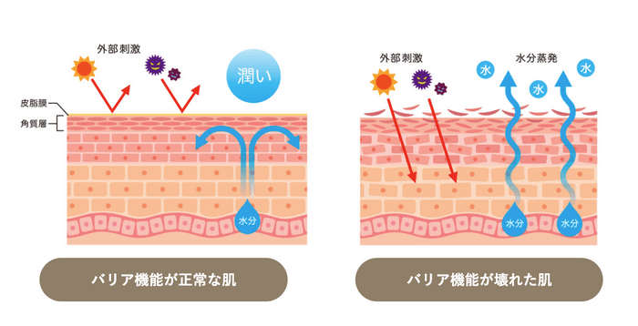 アトピー性皮膚炎の方の共通の肌状態