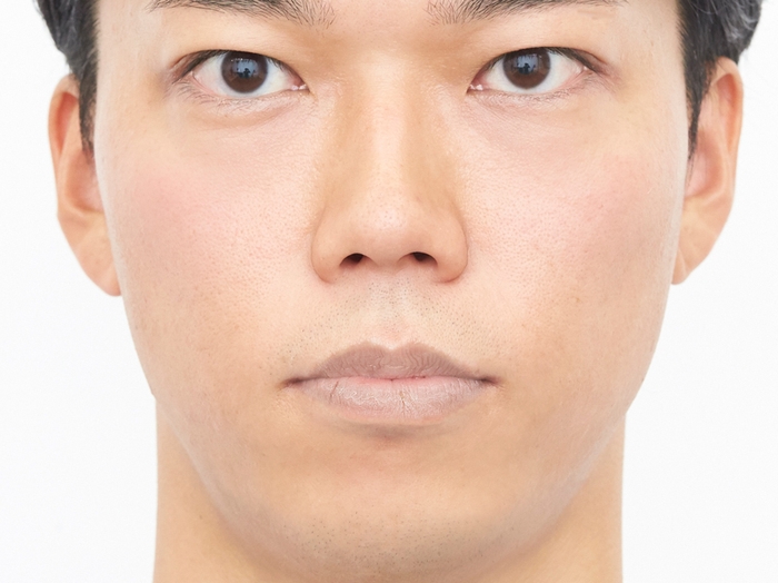 D:唇が荒れている男性