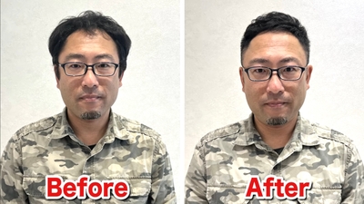 M字薄毛をカットで改善(3)