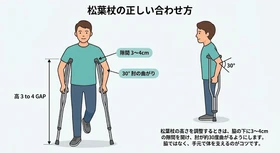 【整形外科医解説】階段の上りはどっちの足から？間違えると危険な松葉杖の正しい歩き方とコツ