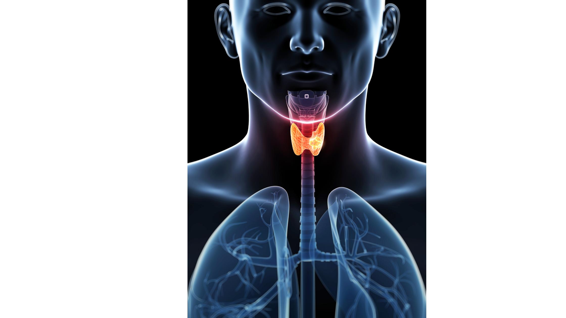 甲状腺がん診断の市場規模は2028年までに37億米ドルに達する見込み