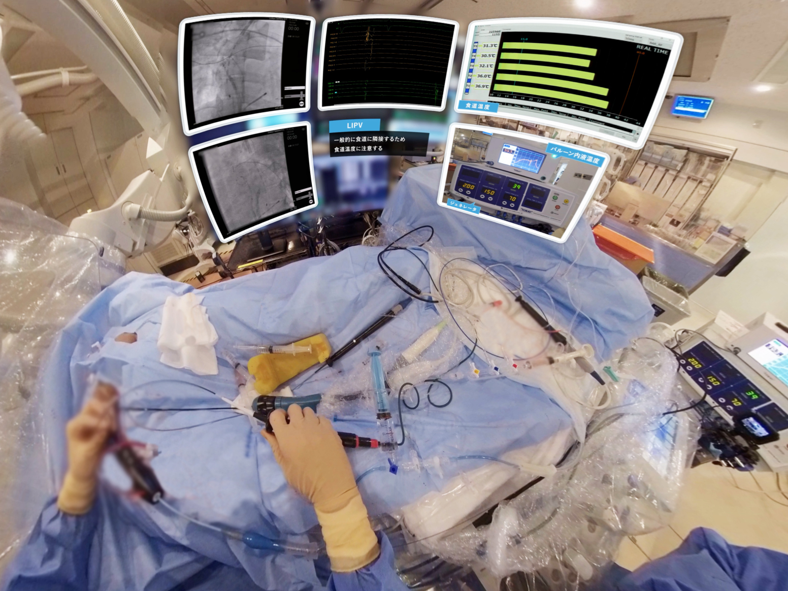 東レの医療機器教育VRを開発！コロナ禍でもHotBalloon™治療の適正な教育をVRで提供、普及を加速