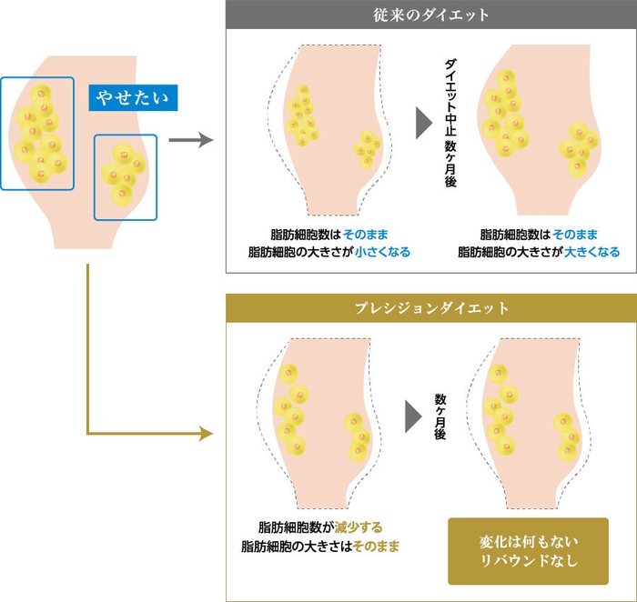 痩せられない原因とは？