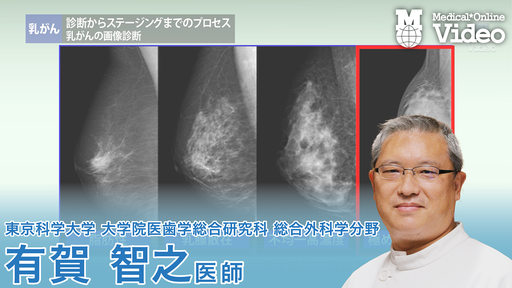 乳がん 診断からステージング