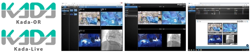 手術映像収録配信システム『Kada-OR』　 循環器内科向け映像収録配信システム『Kada-Live』新発売