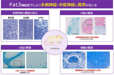 図3:マウスモデルによる神経系への影響 FAT3遺伝子の機能低下により、末梢神経の構造異常と、大脳・小脳・脊髄にわたる広範な神経障害が生じることが確認された。