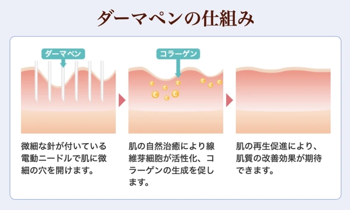 ダーマペン仕組み