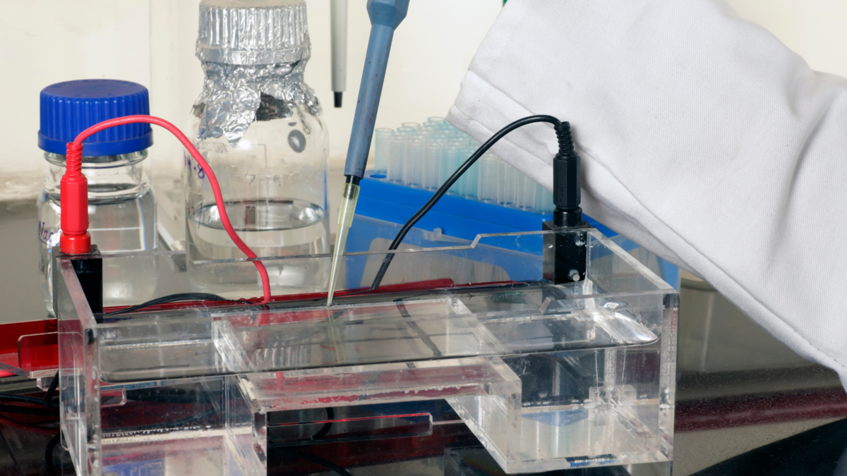 世界のメンブレン・クロマトグラフィー市場はCAGR 16%で成長する見込み