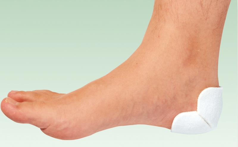 創傷面に合わせたカット例:踵