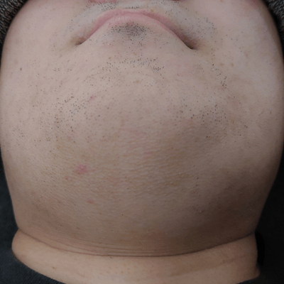 6回目の写真