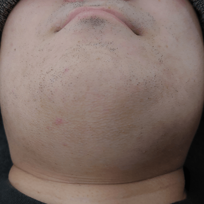 6回目の写真