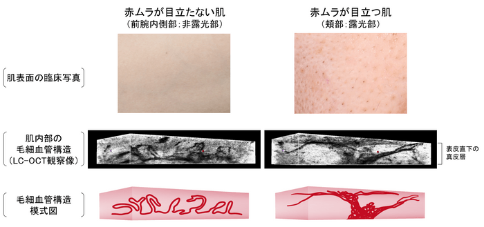 図1 非露光部と露光部の肌内部構造の違い