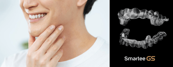 世界が認める「Smartee(スマーティー)」の実力