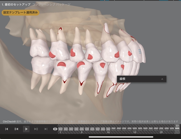 AIによるシミュレーション（23ステージ）