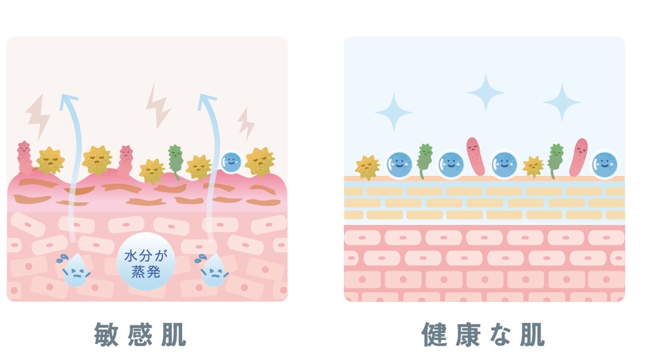 健康肌と敏感肌の肌状態比較