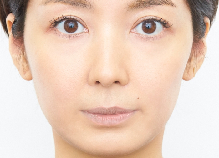 B:唇が荒れている女性