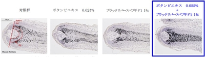 Auber's line:毛球部の最も太い部分を横断する線 PU:メラニン量測定エリア