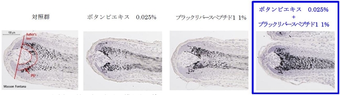 Auber's line：毛球部の最も太い部分を横断する線　 PU：メラニン量測定エリア 