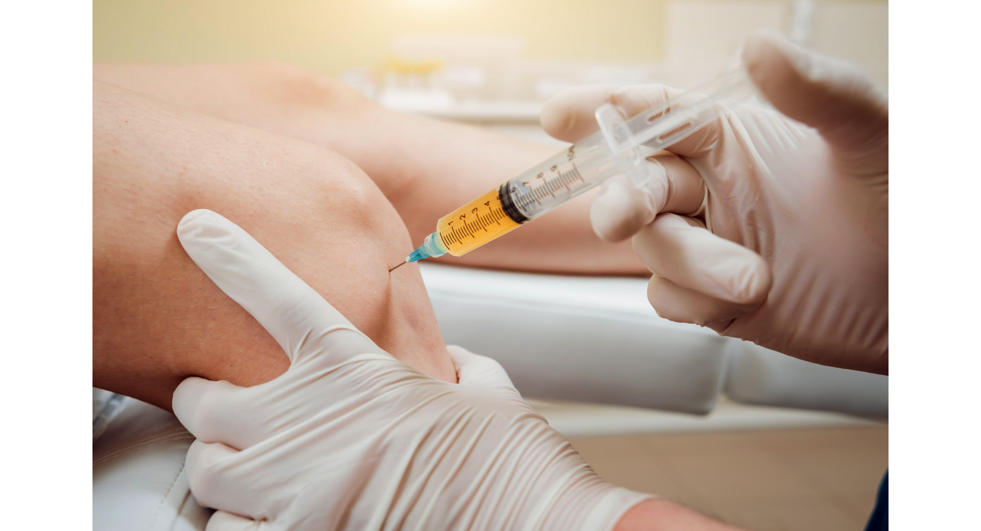 ビスコサプリレーション市場は、2026年までに年率8.2%で成長し、66億米ドルに達すると推定される