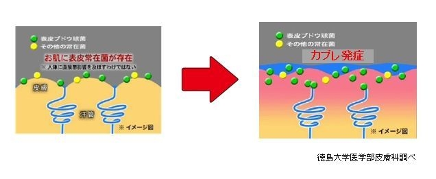 汗によるカブレ発生メカニズム(イメージ図)