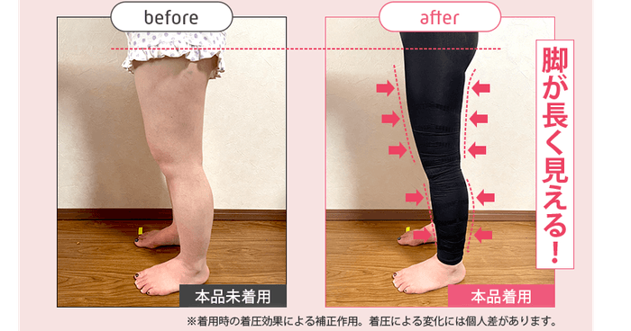 ストレグ脚のBefore/After