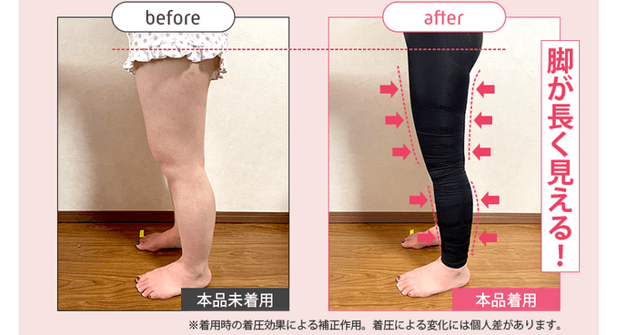 ストレグ脚のBefore／After