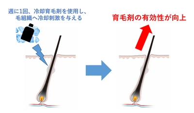 富士産業、週に1回 頭皮の冷却刺激により 育毛効果が向上する、新たな育毛アプローチを発見　 ～ヒトへの有効性の研究成果を報告(第47回 日本香粧品学会)～