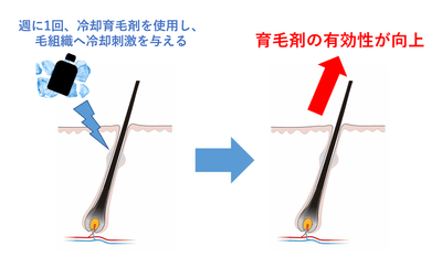 図1:週に1回の冷却刺激により育毛効果が向上