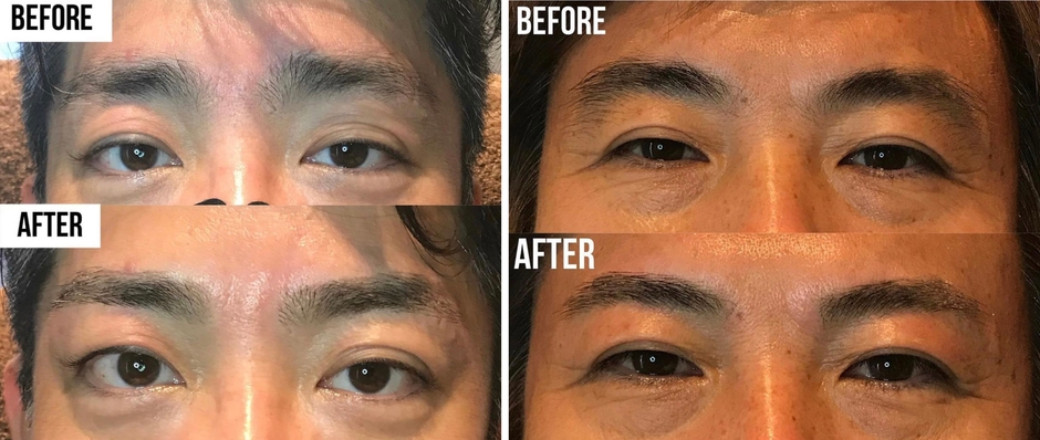 メンズ専用眉毛サロン「眉ダンディズム本町店」ビフォー/アフター