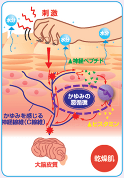 かゆみの悪循環