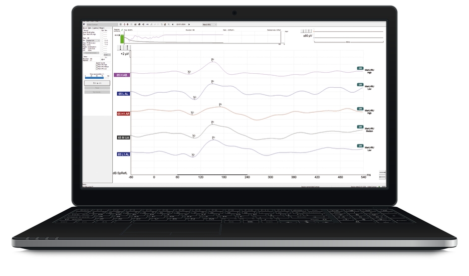 皮質聴覚誘発電位検査画面
