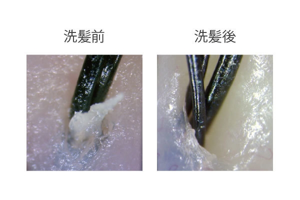 指では除去できない毛穴に詰まった汚れをしっかりと除去