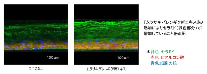 『ムラサキバレンギク新エキス』添加によるセラミドの変化