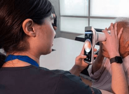 図.スマートフォンベースの眼底カメラの製品画像