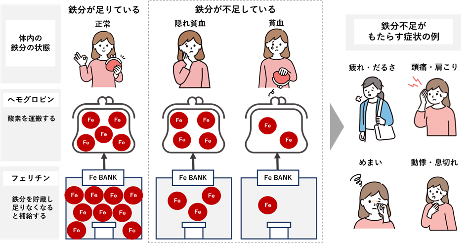 弘前大学・京都大学との共同研究で健康ビックデータから『女性のメンタル不調』に『鉄分不足』が関係していることを確認