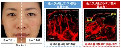 日本メナード化粧品、肌の美しさを低下させる 「色ムラ」が生じるメカニズムを解明！